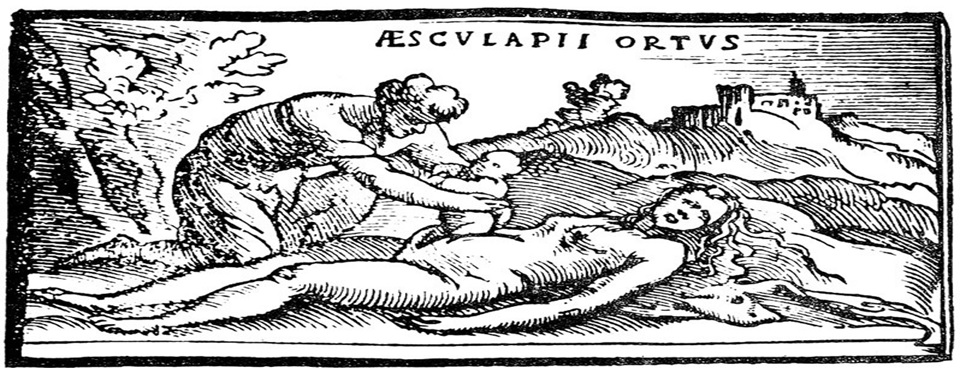 Article : La césarienne : mythologie et histoire