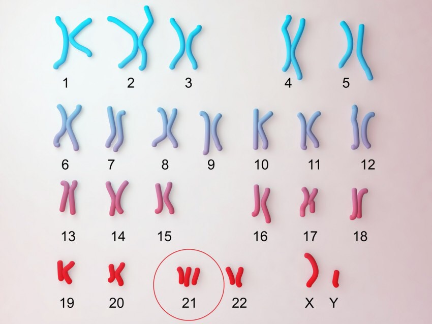 Article : Comprendre la trisomie 21